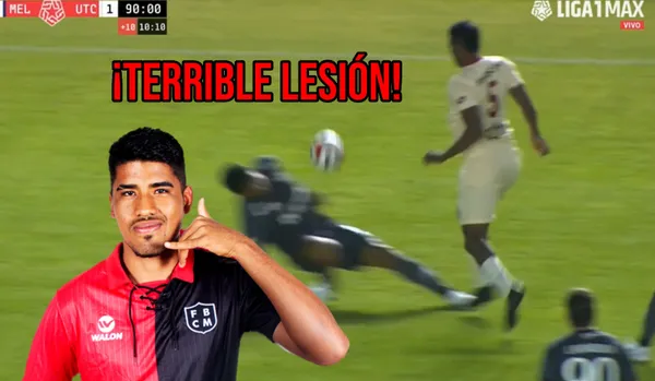 Defensor de Melgar sufrió una terrible, aunque se confirmó que no es nada de gravedad.