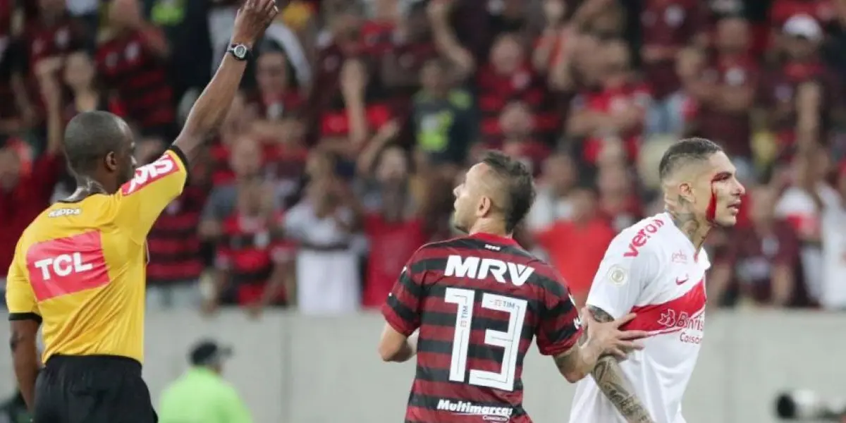 Así le quedó la cara a Guerrero después del golpe que recibió