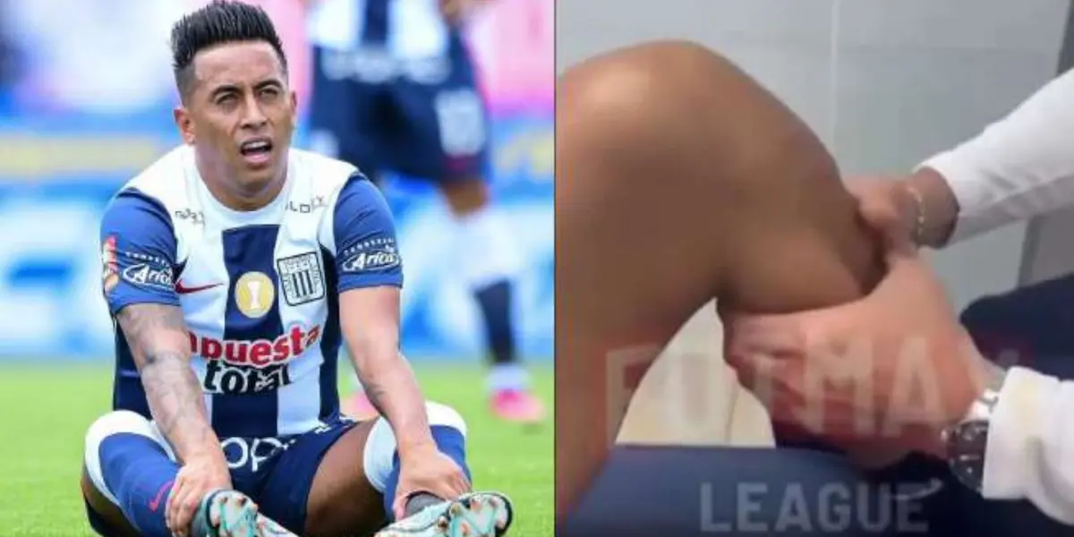Christian Cueva y como estaba su rodilla.