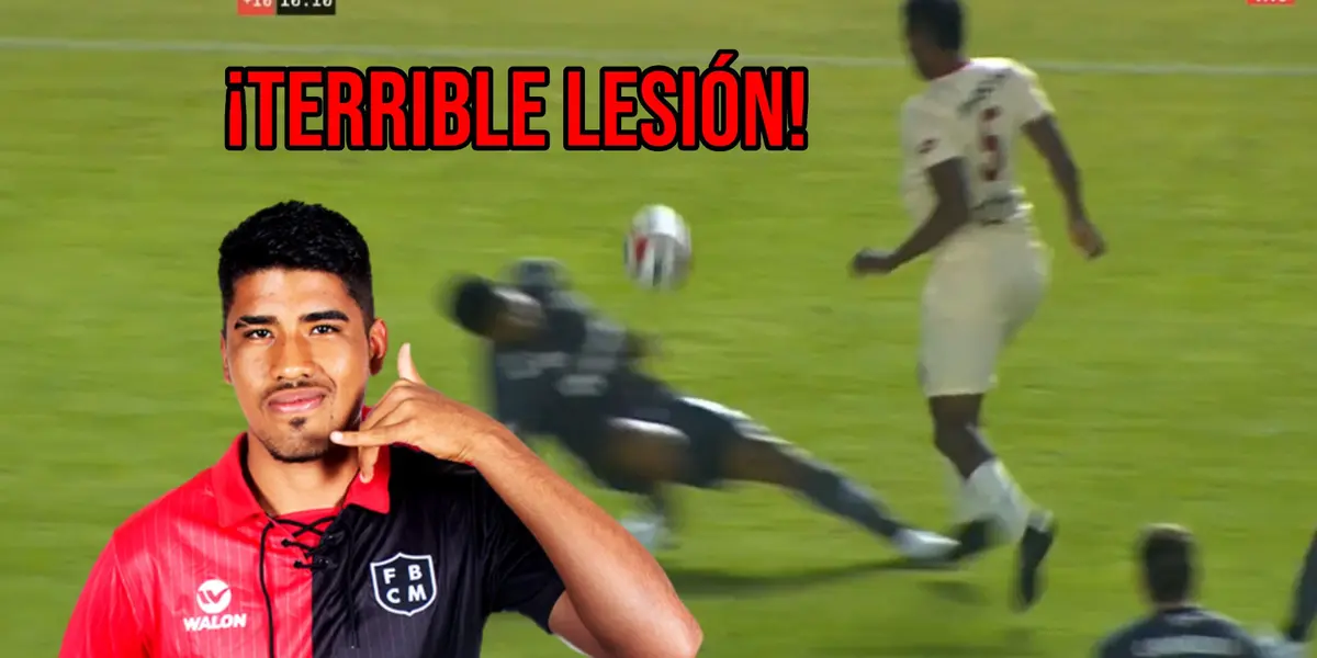 Defensor de Melgar sufrió una terrible, aunque se confirmó que no es nada de gravedad.