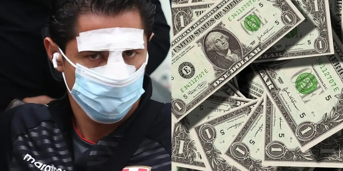 Gianluca Lapadula sufrió un fractura de nariz en el partido ante Paraguay.